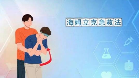 海姆立克腹部冲击法